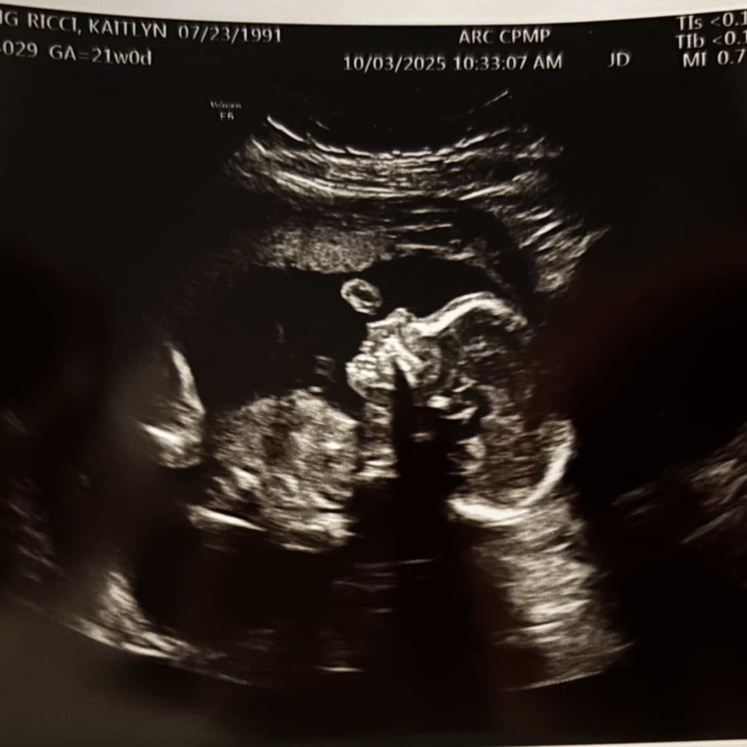 Photo shared by Kaitlyn for their Babylist baby registry.