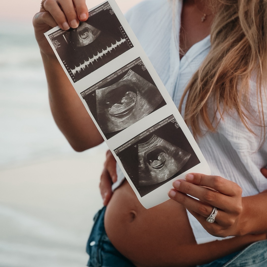 Photo shared by Ashleigh for their Babylist baby registry.