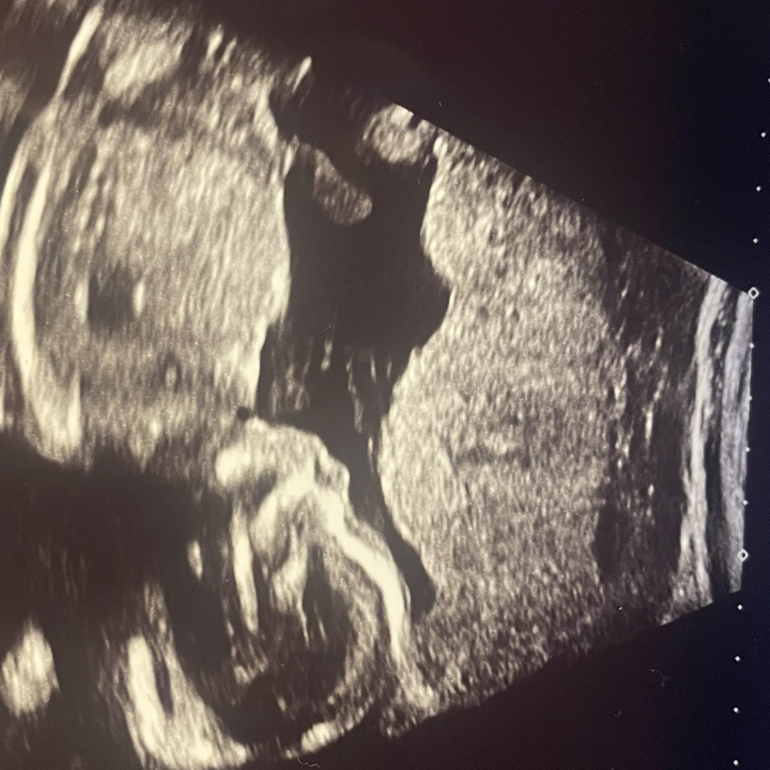 Photo shared by Kati for their Babylist baby registry.