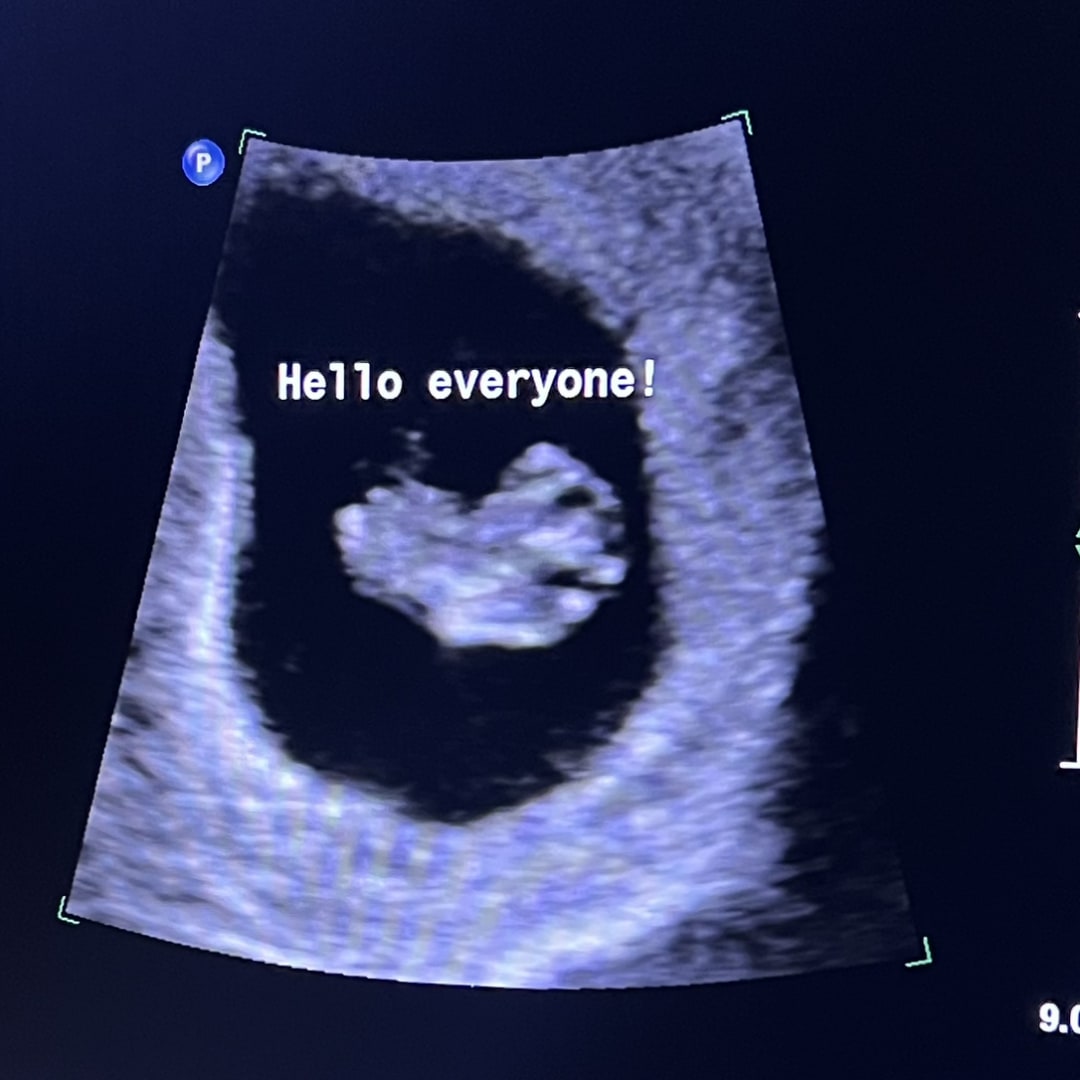 Photo shared by Katee for their Babylist baby registry.