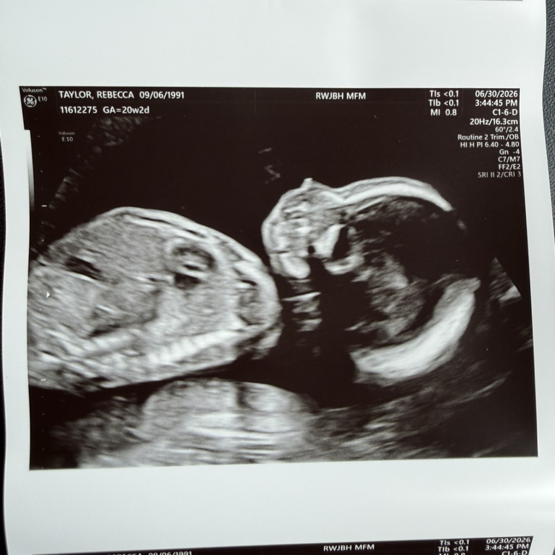 Photo shared by Rebecca for their Babylist baby registry.