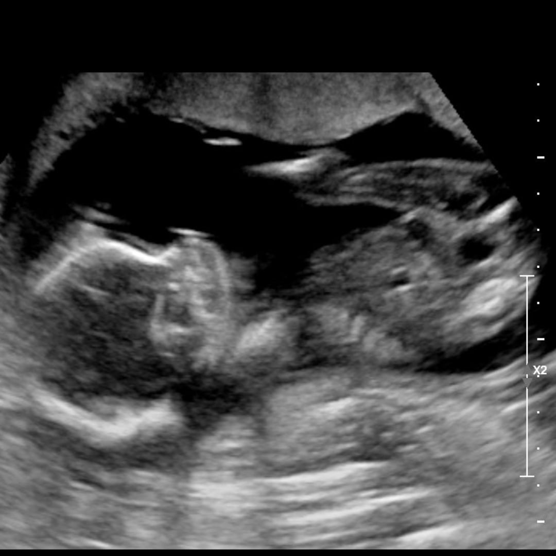 Photo shared by Annemarie for their Babylist baby registry.