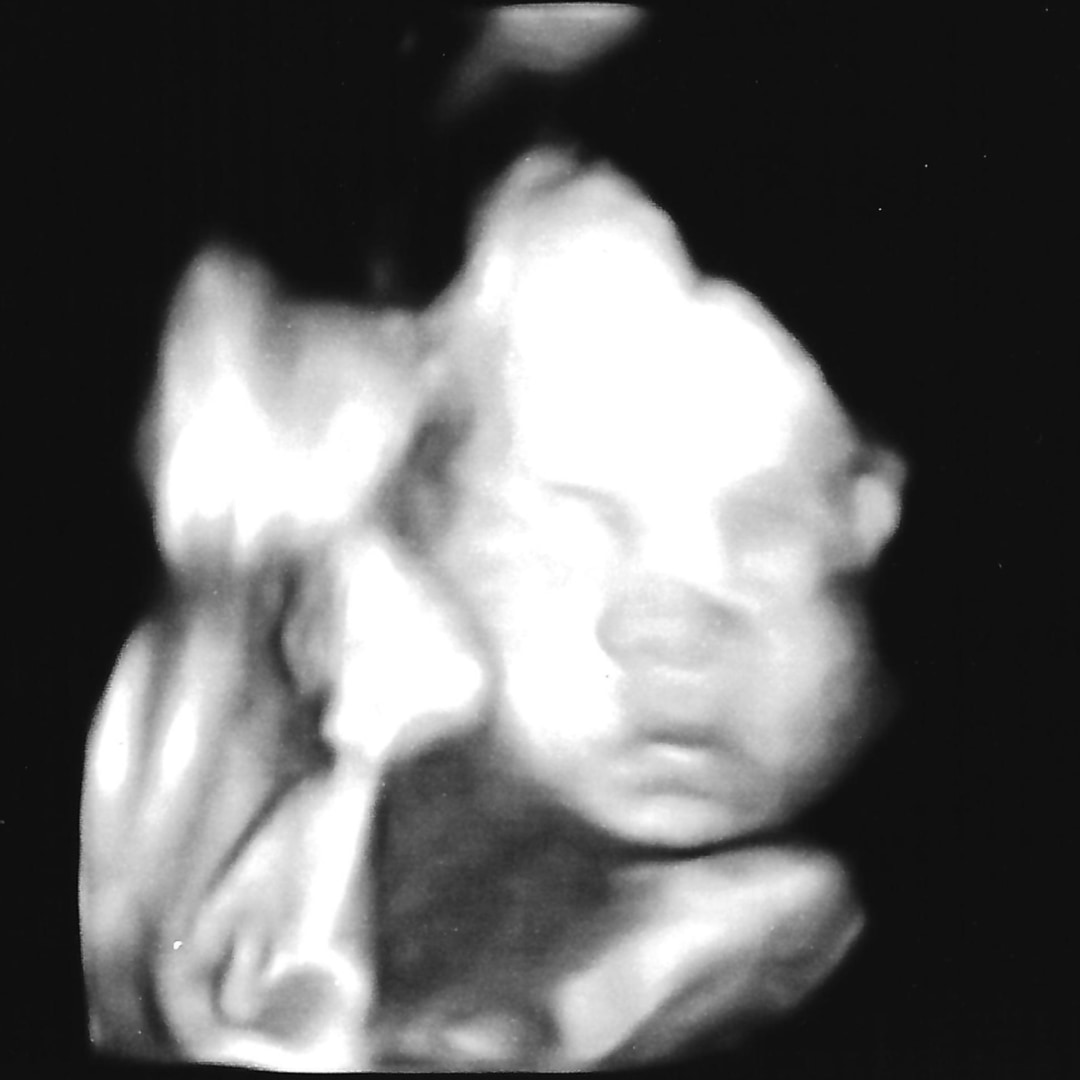 Photo shared by Hannah for their Babylist baby registry.