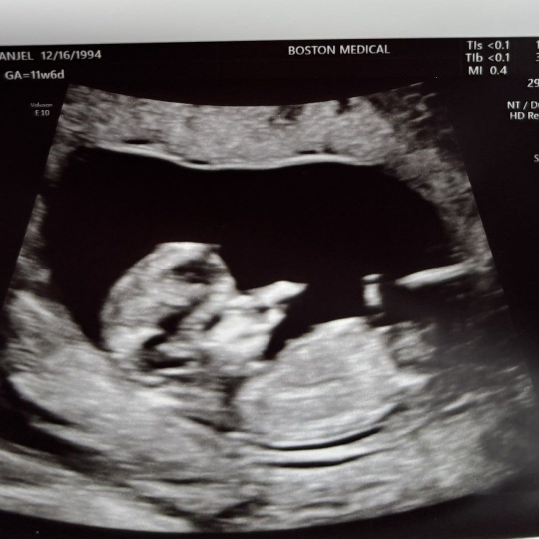 Photo shared by Anjel for their Babylist baby registry.