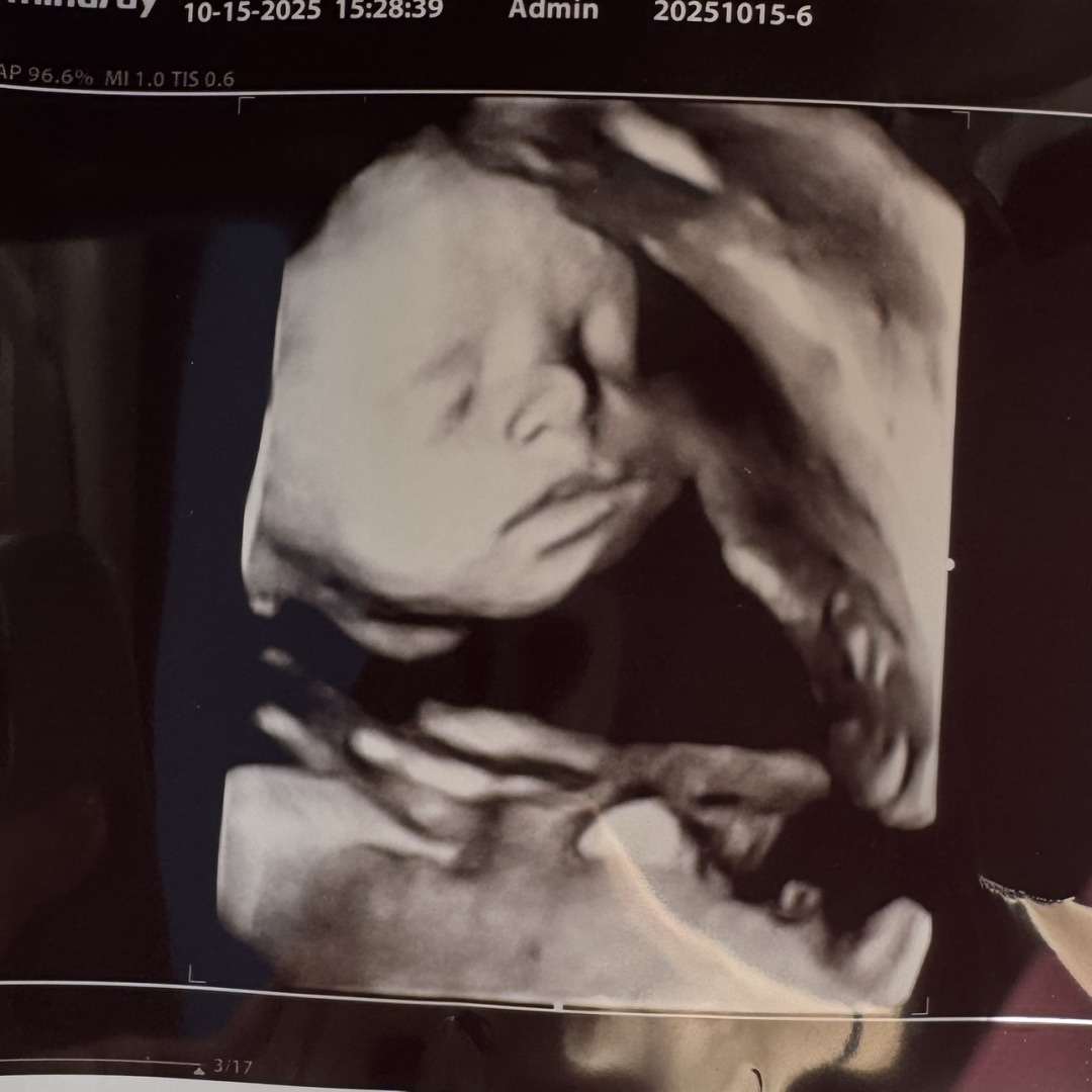 Photo shared by Lexy for their Babylist baby registry.