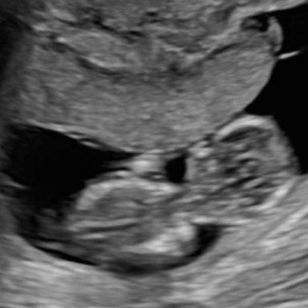Photo shared by Gabi for their Babylist baby registry.