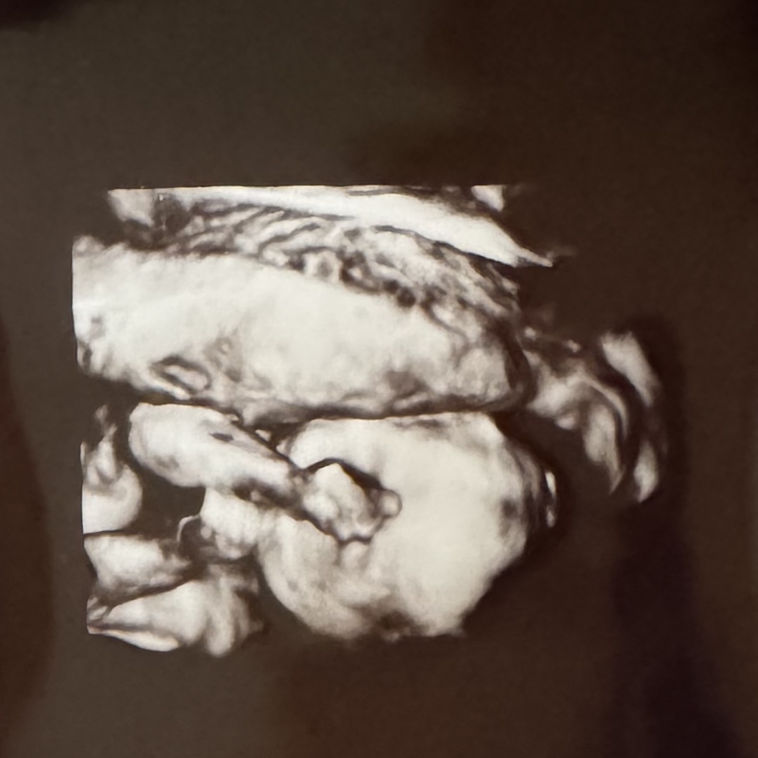 Photo shared by Anastasia for their Babylist baby registry.
