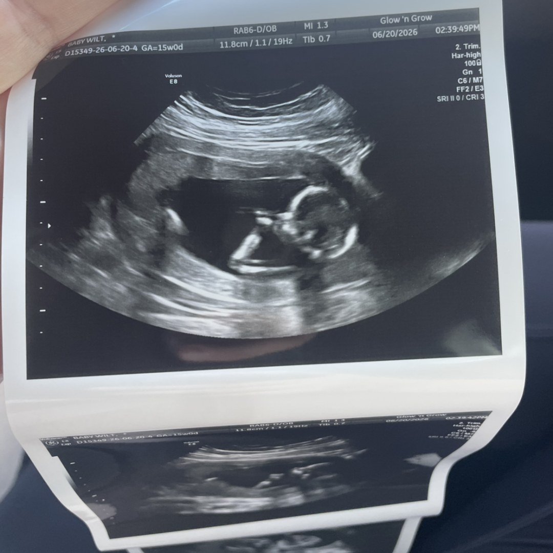 Photo shared by Arian for their Babylist baby registry.