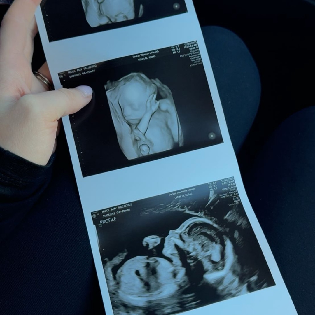 Photo shared by Amy for their Babylist baby registry.