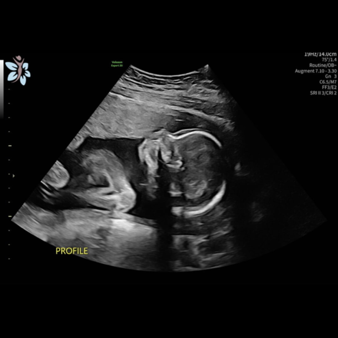 Photo shared by Hannah for their Babylist baby registry.
