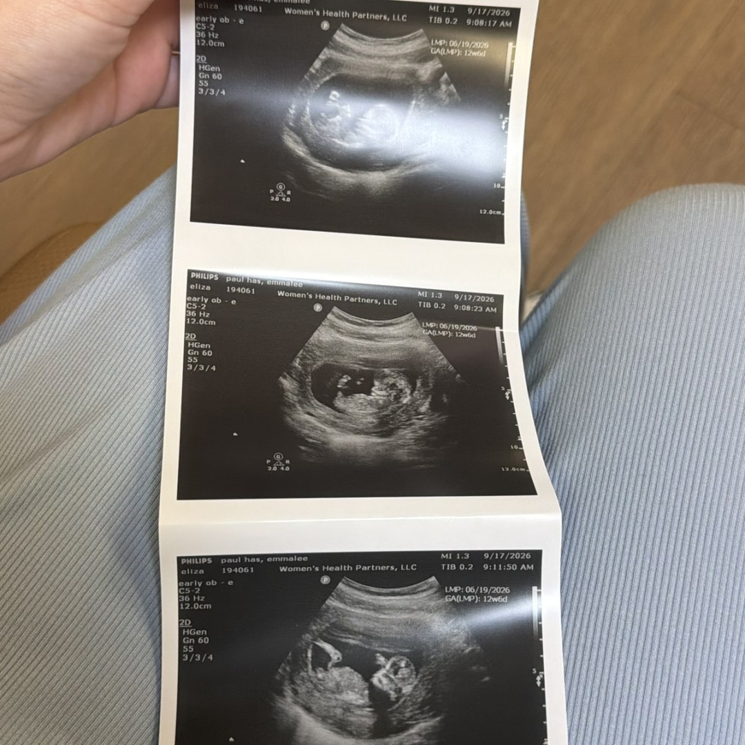 Photo shared by Emmalee for their Babylist baby registry.