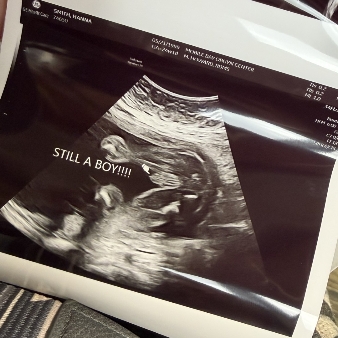 Photo shared by Hanna for their Babylist baby registry.