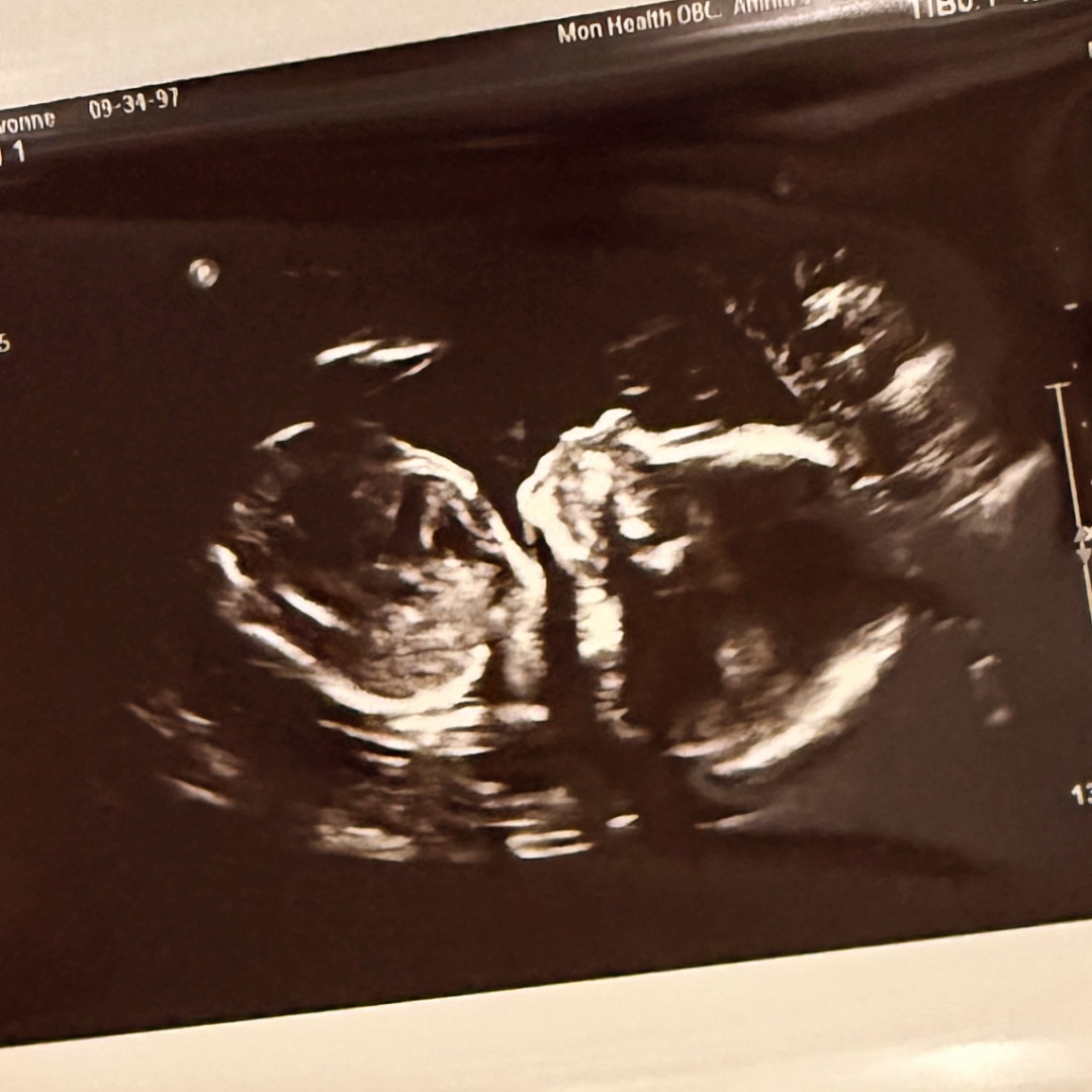 Photo shared by Yvonne for their Babylist baby registry.