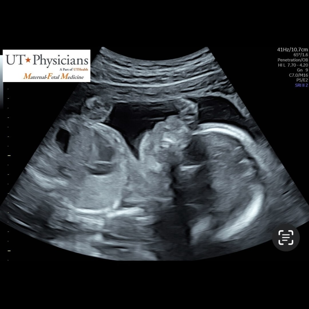 Photo shared by Angela for their Babylist baby registry.