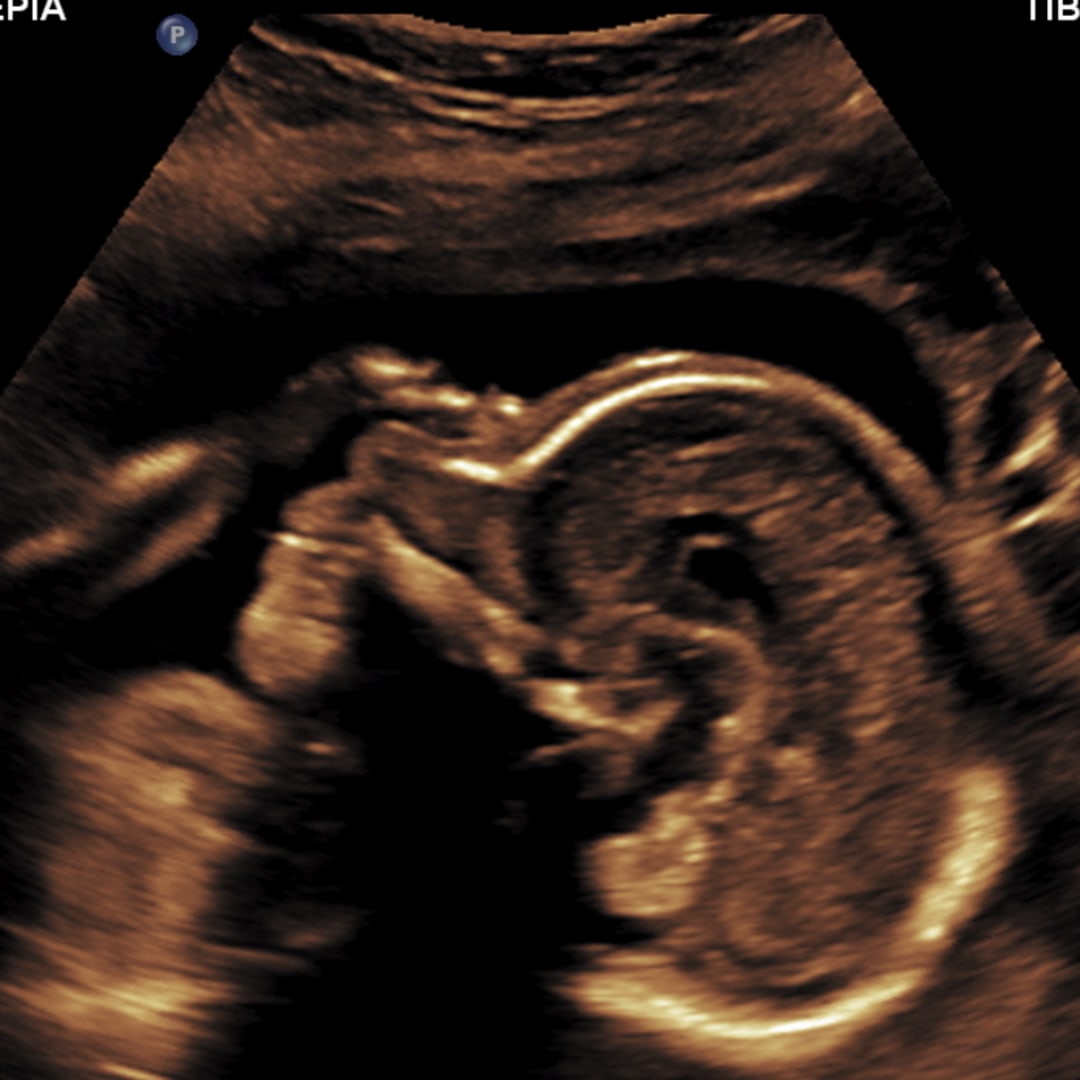 Photo shared by Jordan for their Babylist baby registry.