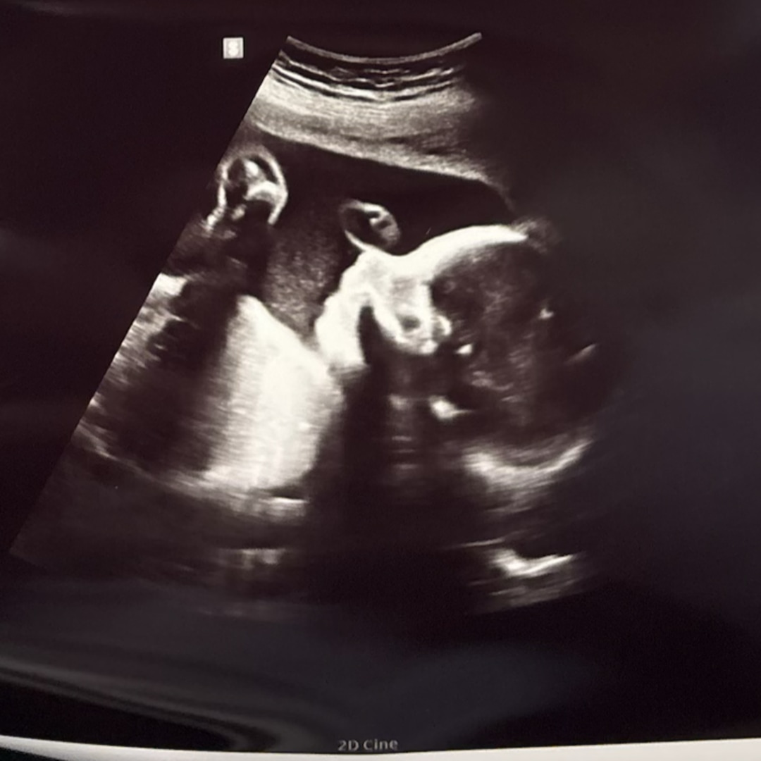 Photo shared by Emma for their Babylist baby registry.