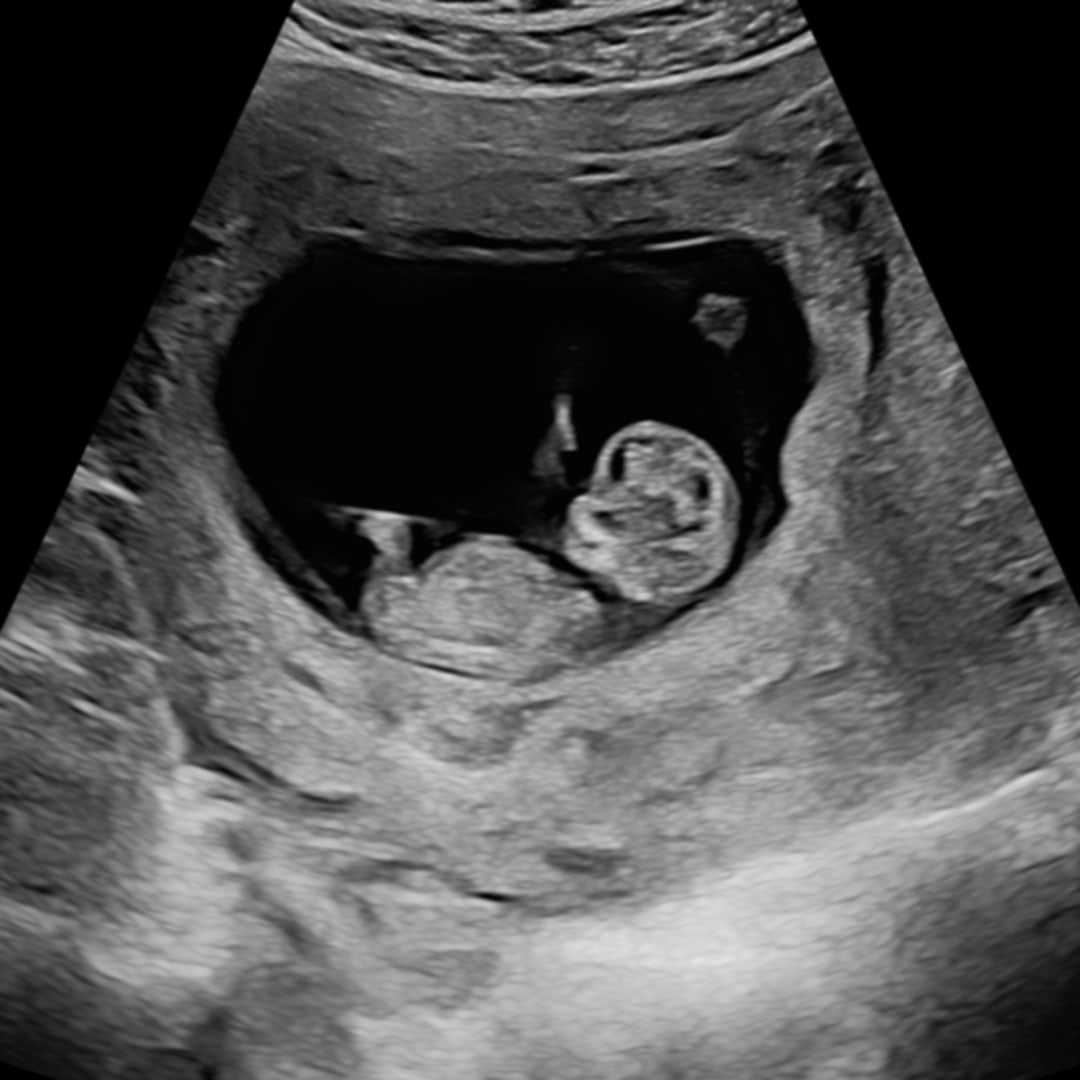 Photo shared by Ashley for their Babylist baby registry.