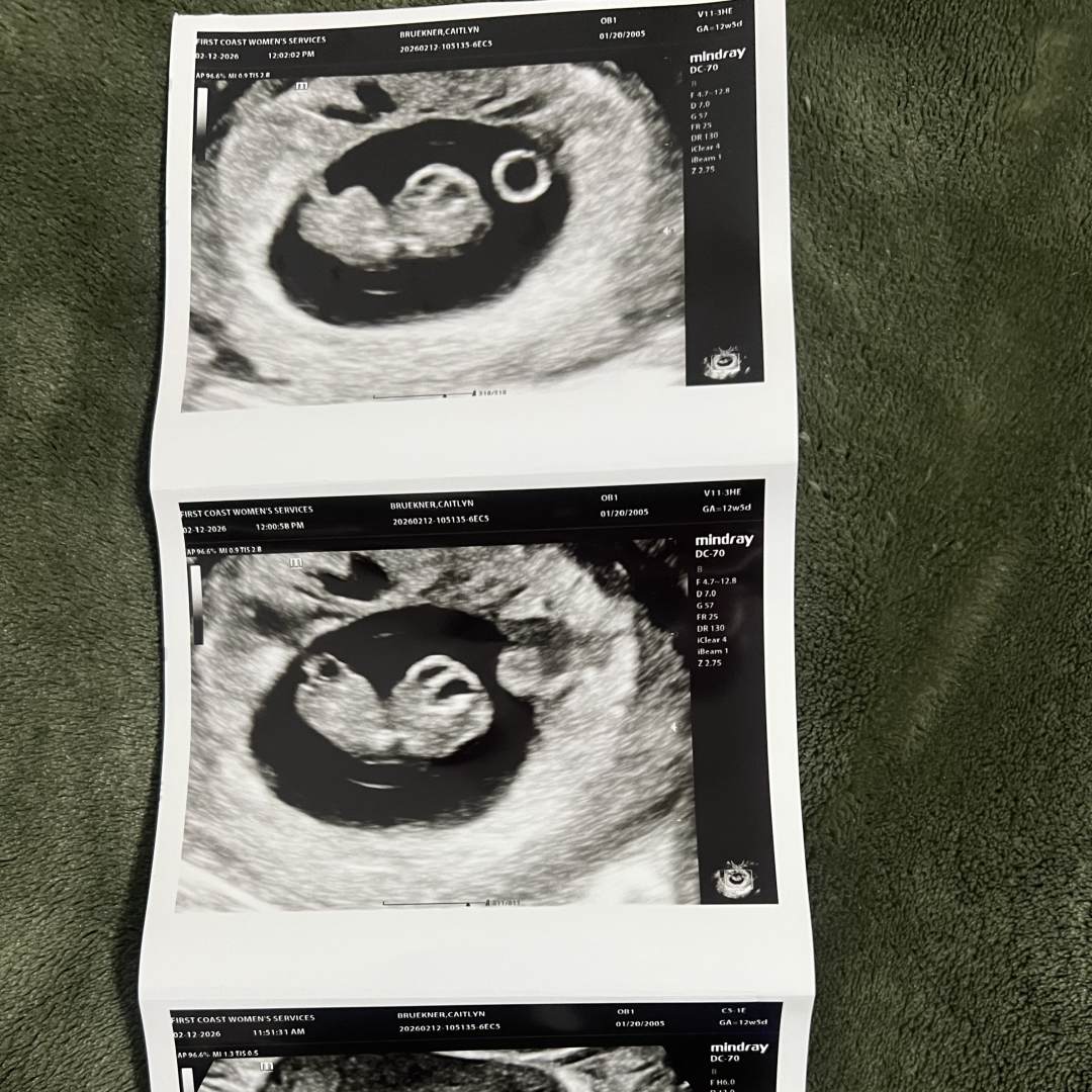 Photo shared by Caitlyn for their Babylist baby registry.