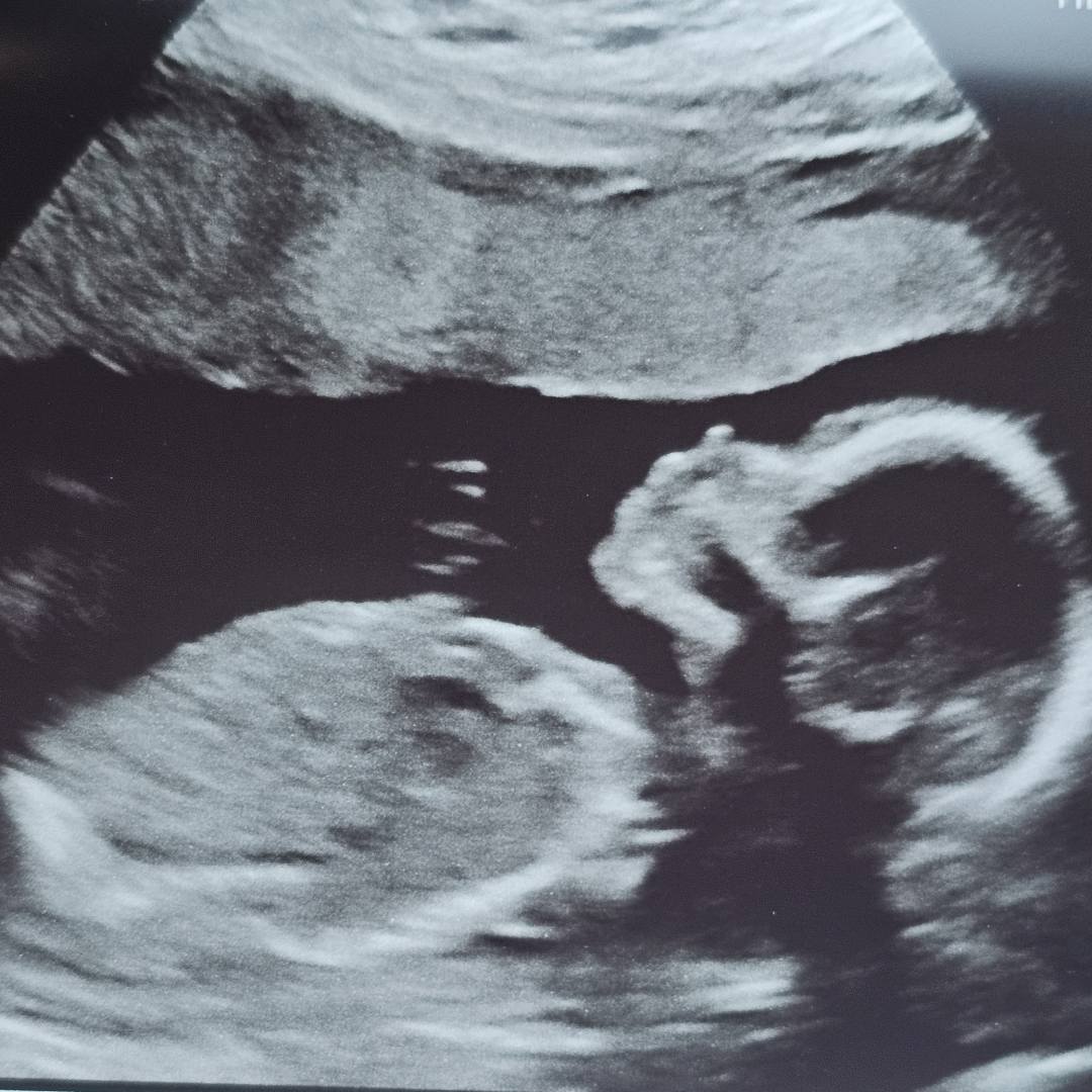 Photo shared by Jenna for their Babylist baby registry.