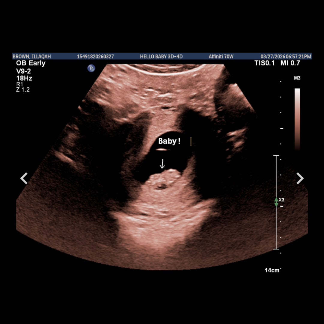 Photo shared by Illaqah for their Babylist baby registry.
