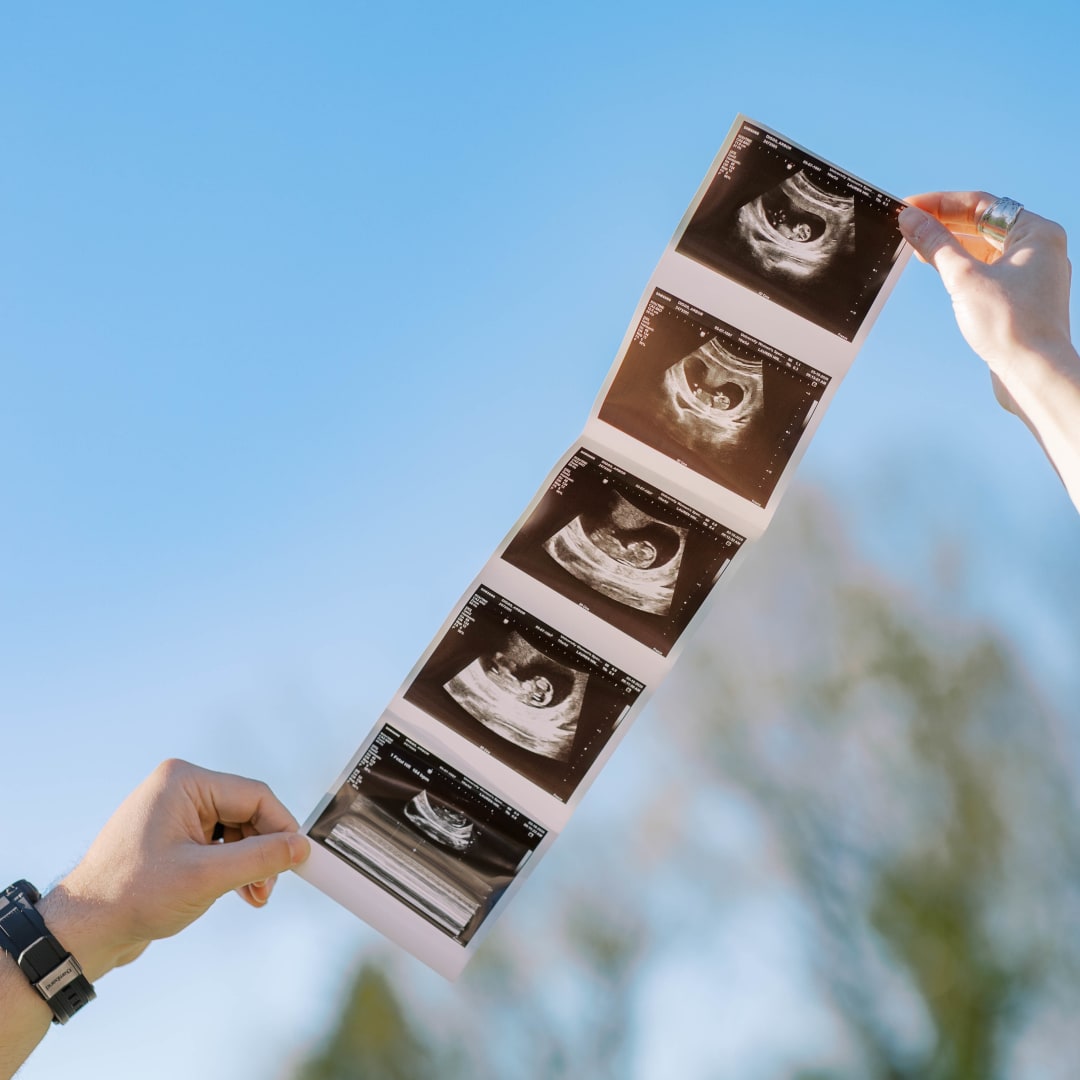 Photo shared by Arbor for their Babylist baby registry.