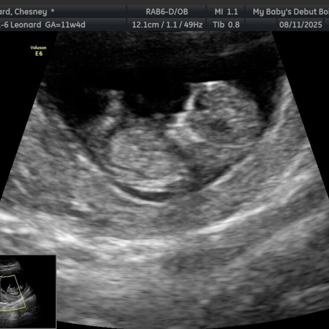 Photo shared by Chesney for their Babylist baby registry.