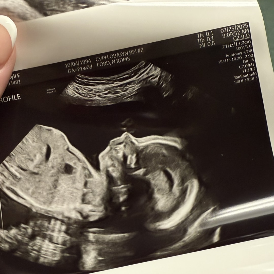 Photo shared by Kyli for their Babylist baby registry.