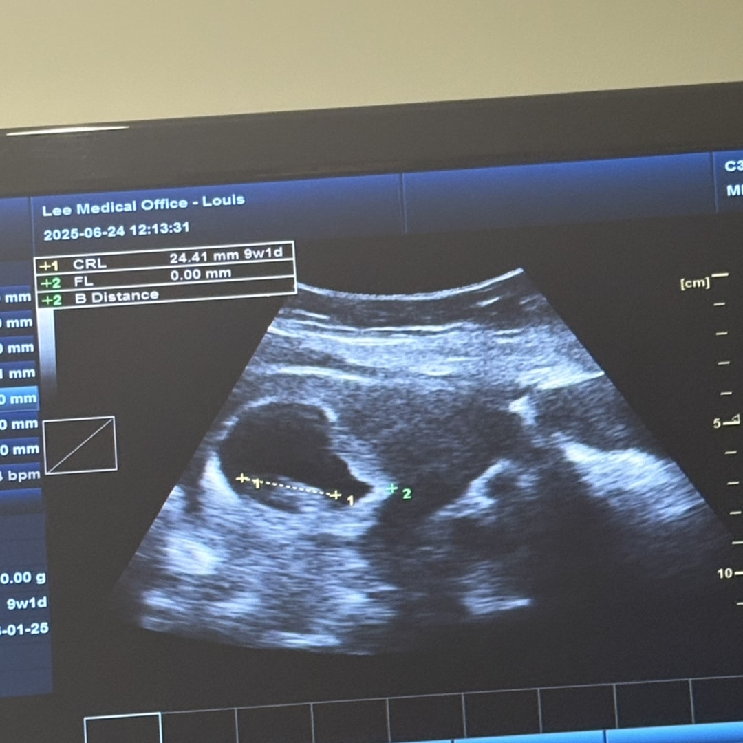 Photo shared by Michelle for their Babylist baby registry.