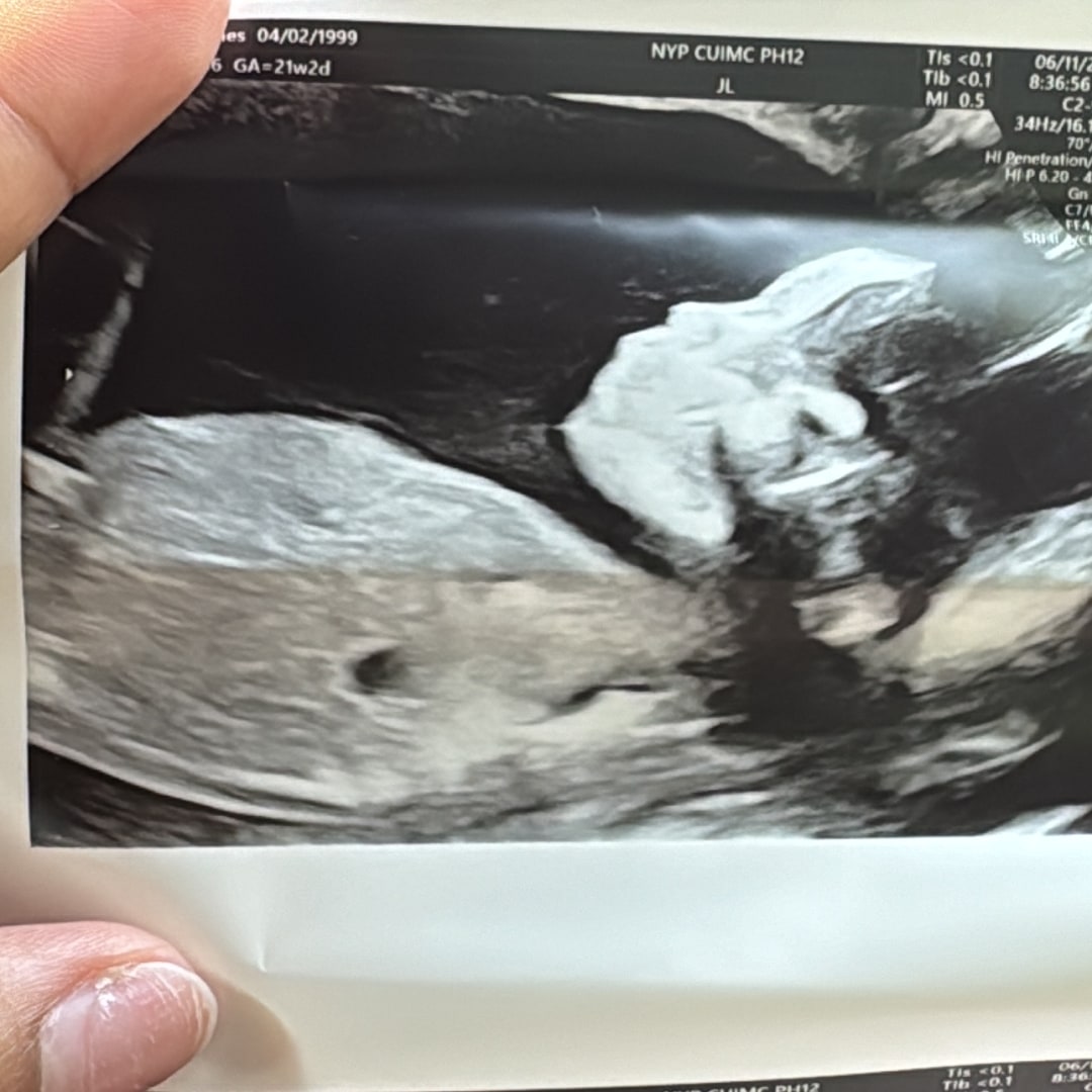 Photo shared by Geraldines for their Babylist baby registry.