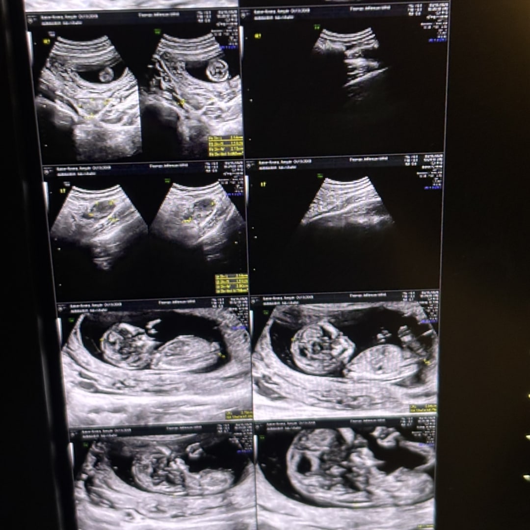 Photo shared by Amyah for their Babylist baby registry.