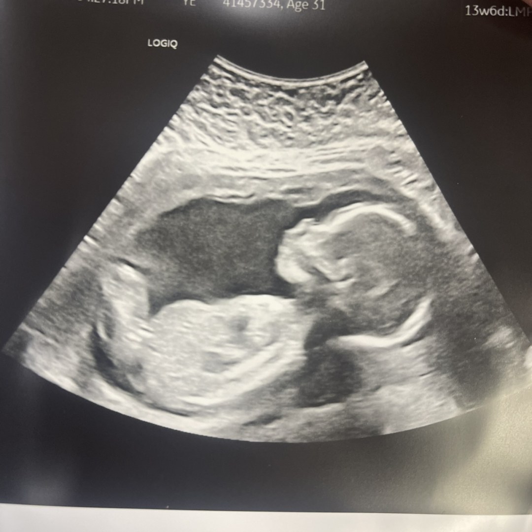 Photo shared by Nicole for their Babylist baby registry.