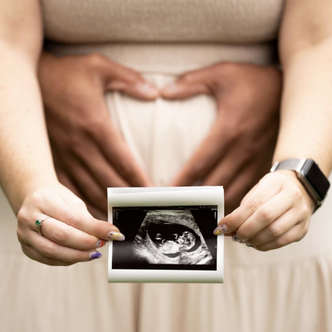 Photo shared by Victoria for their Babylist baby registry.