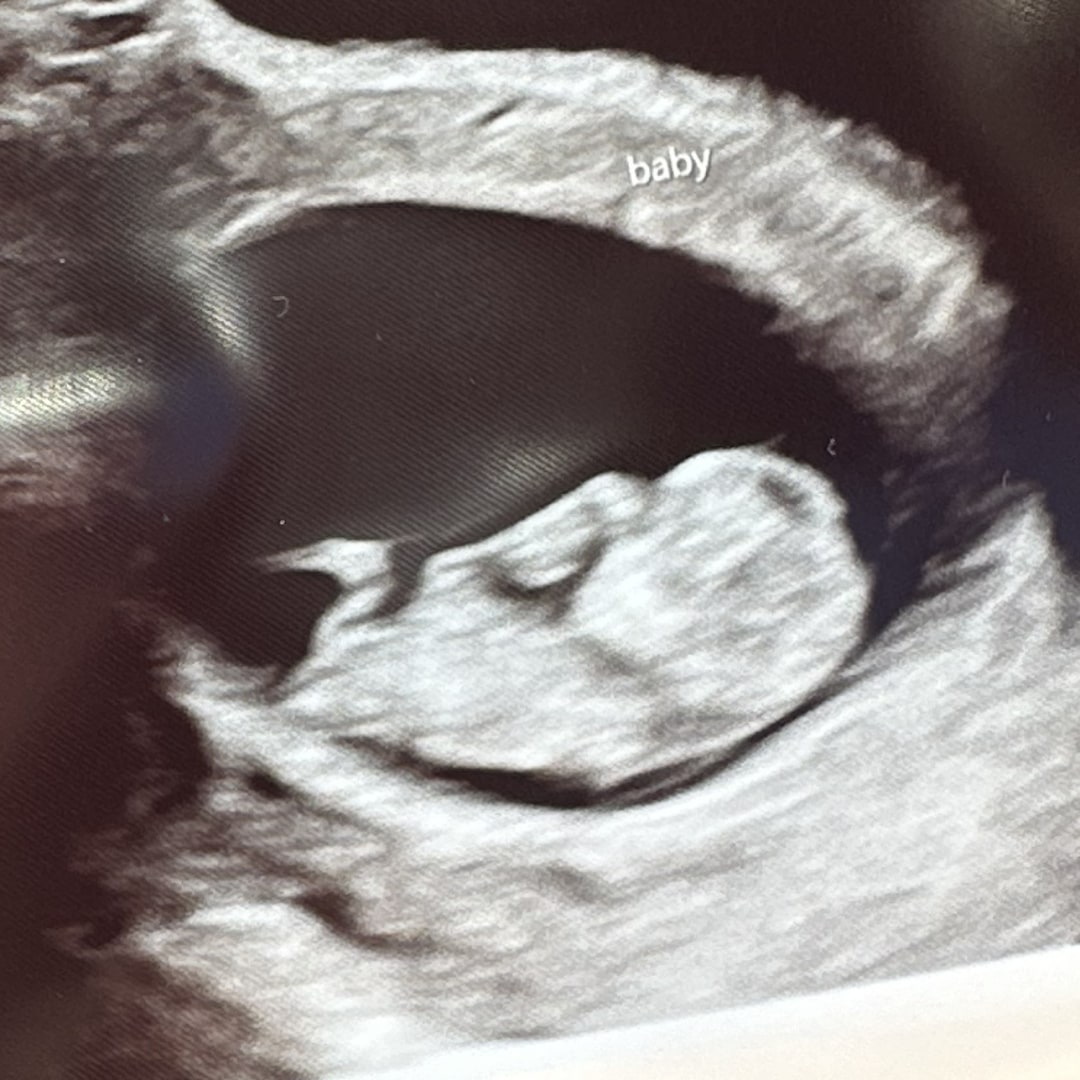 Photo shared by Kelly for their Babylist baby registry.