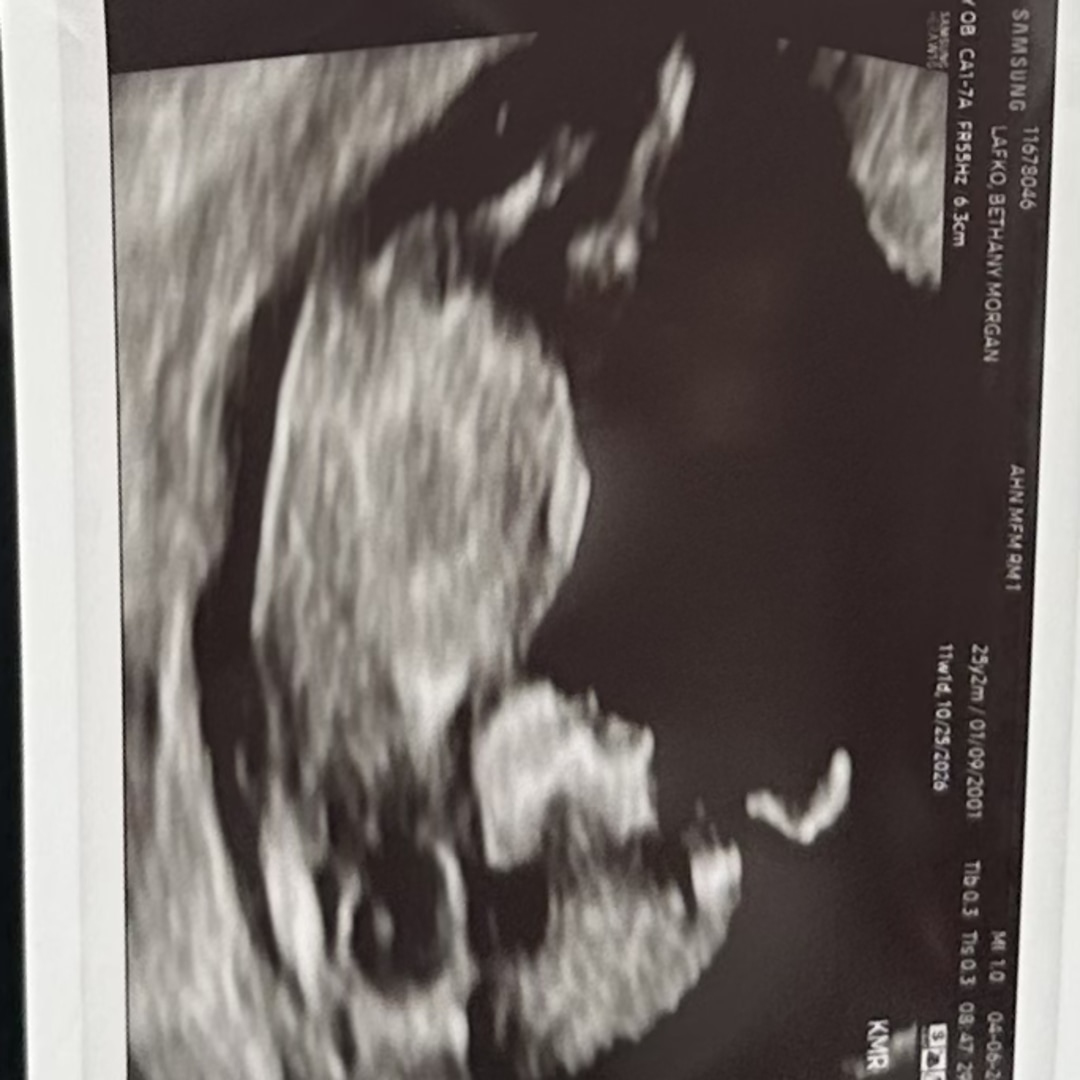 Photo shared by Bethany for their Babylist baby registry.