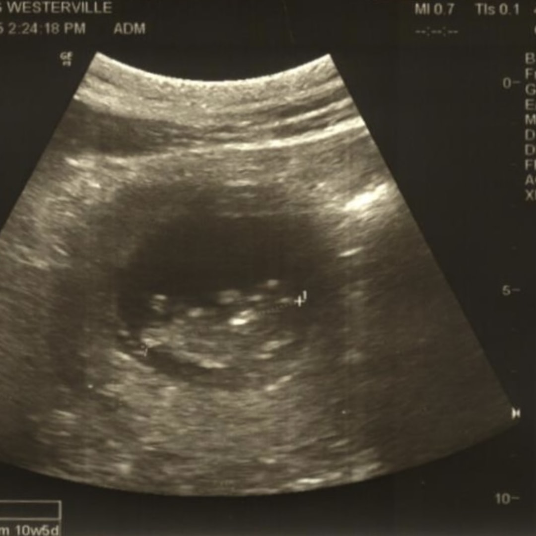 Photo shared by Mara for their Babylist baby registry.