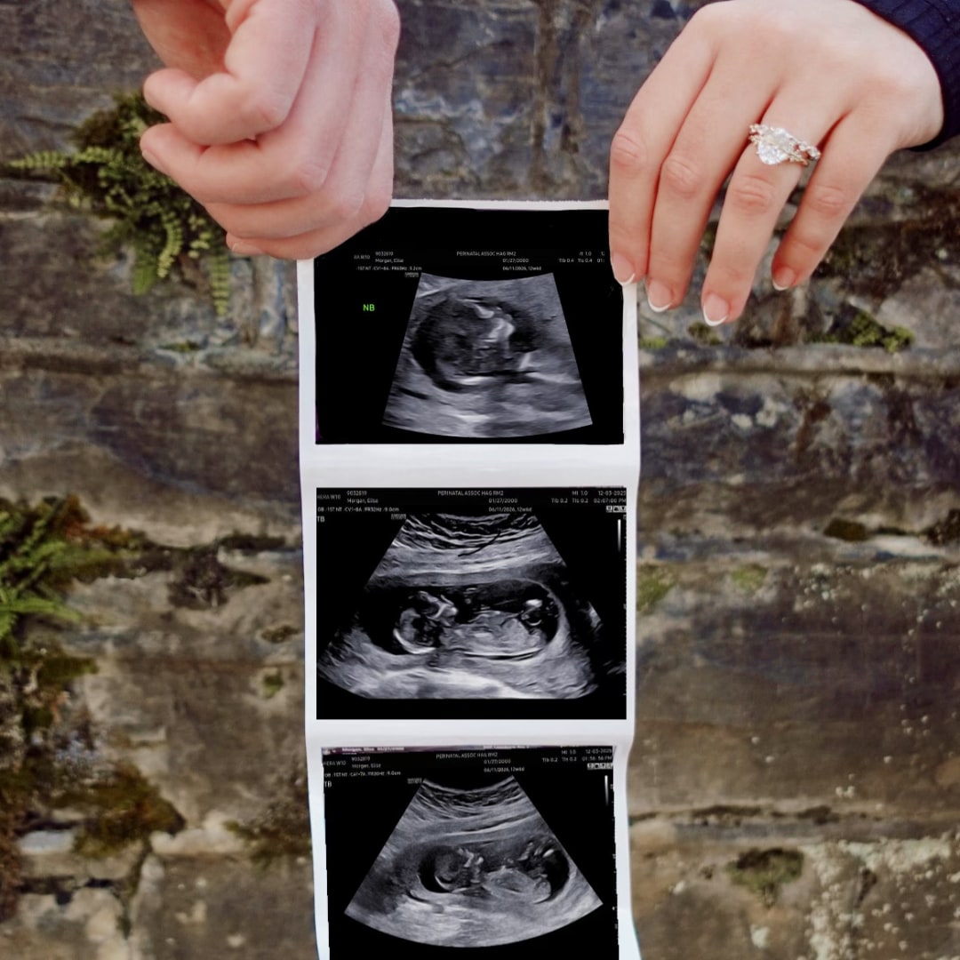 Photo shared by Elise for their Babylist baby registry.