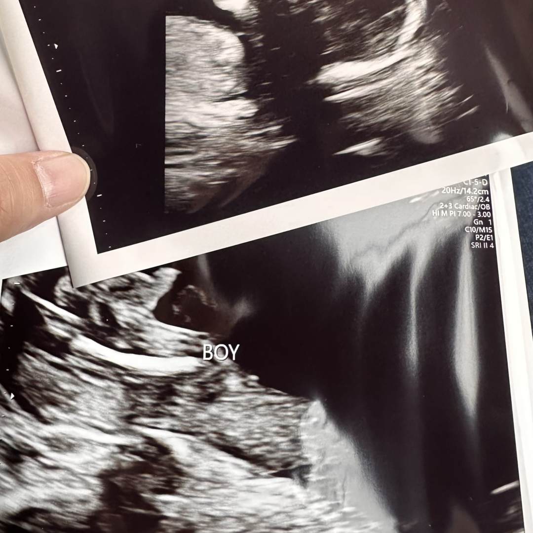 Photo shared by Charlize Jasmine for their Babylist baby registry.