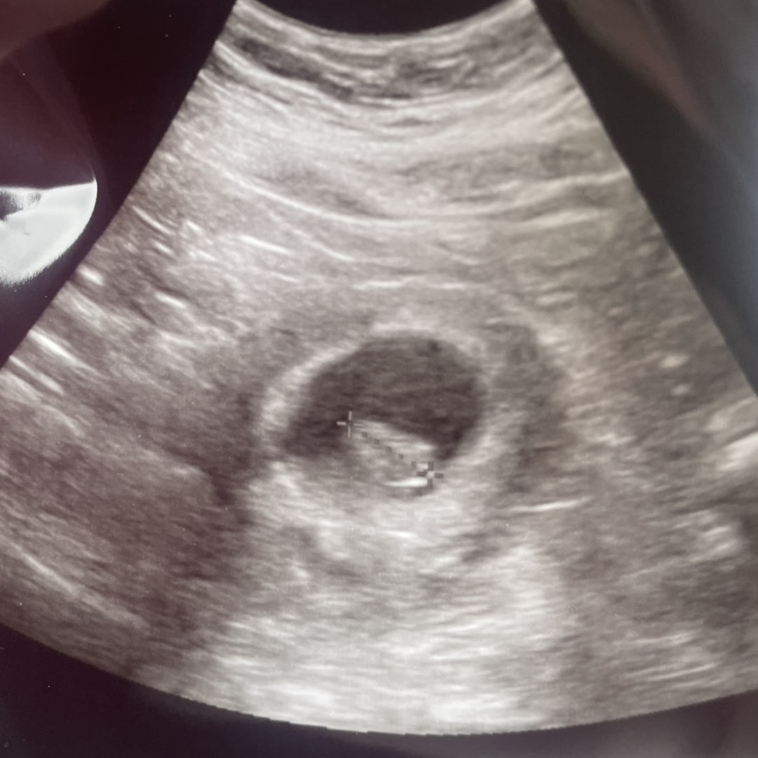 Photo shared by Brenna for their Babylist baby registry.