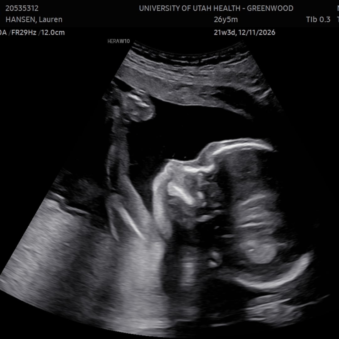 Photo shared by Lauren for their Babylist baby registry.