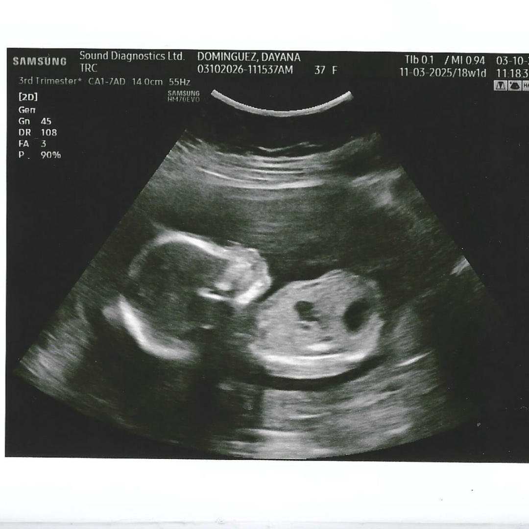 Photo shared by Dayana for their Babylist baby registry.