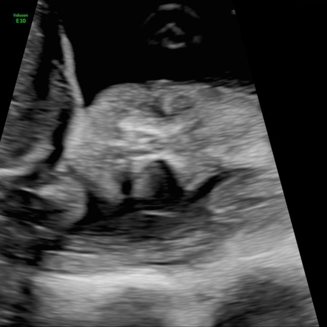 Photo shared by Adelia for their Babylist baby registry.