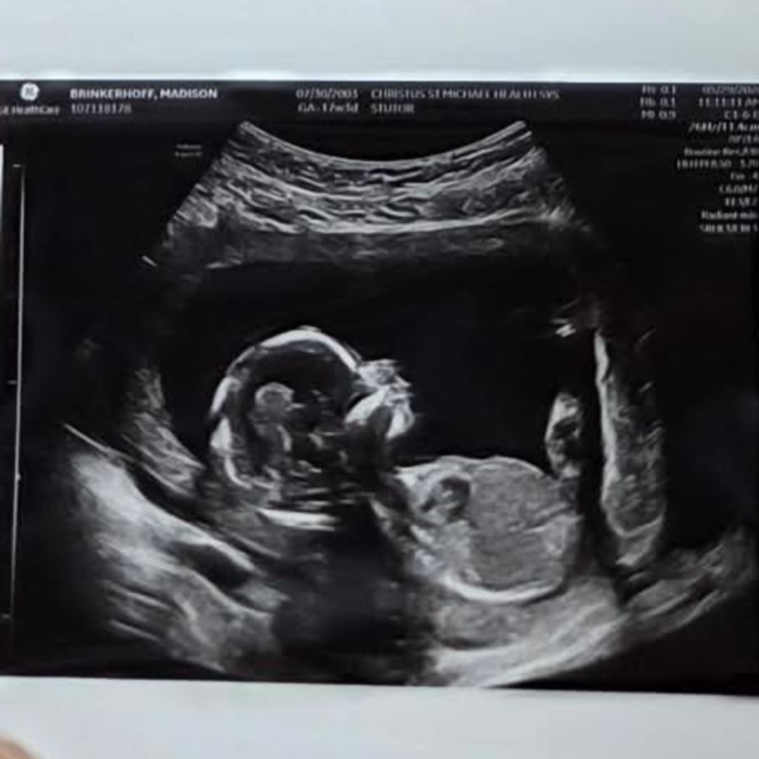Photo shared by Madison for their Babylist baby registry.