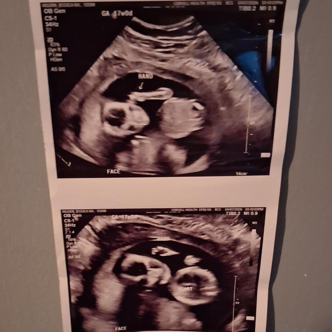 Photo shared by Jessica for their Babylist baby registry.