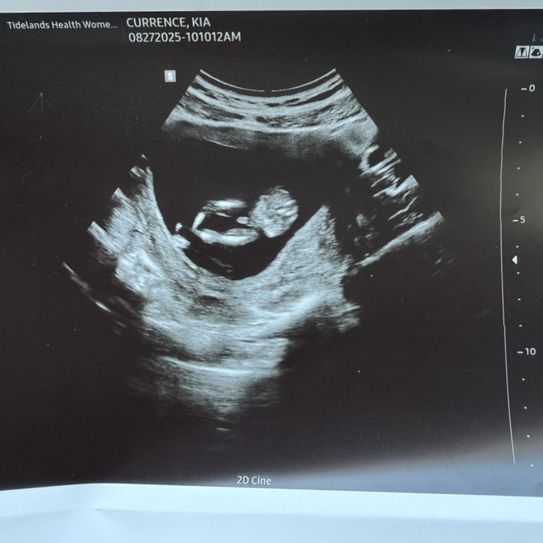 Photo shared by Kia for their Babylist baby registry.