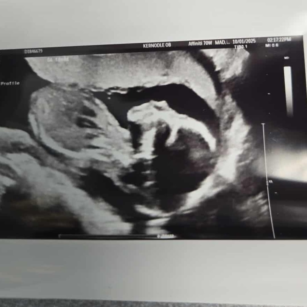 Photo shared by Heather for their Babylist baby registry.