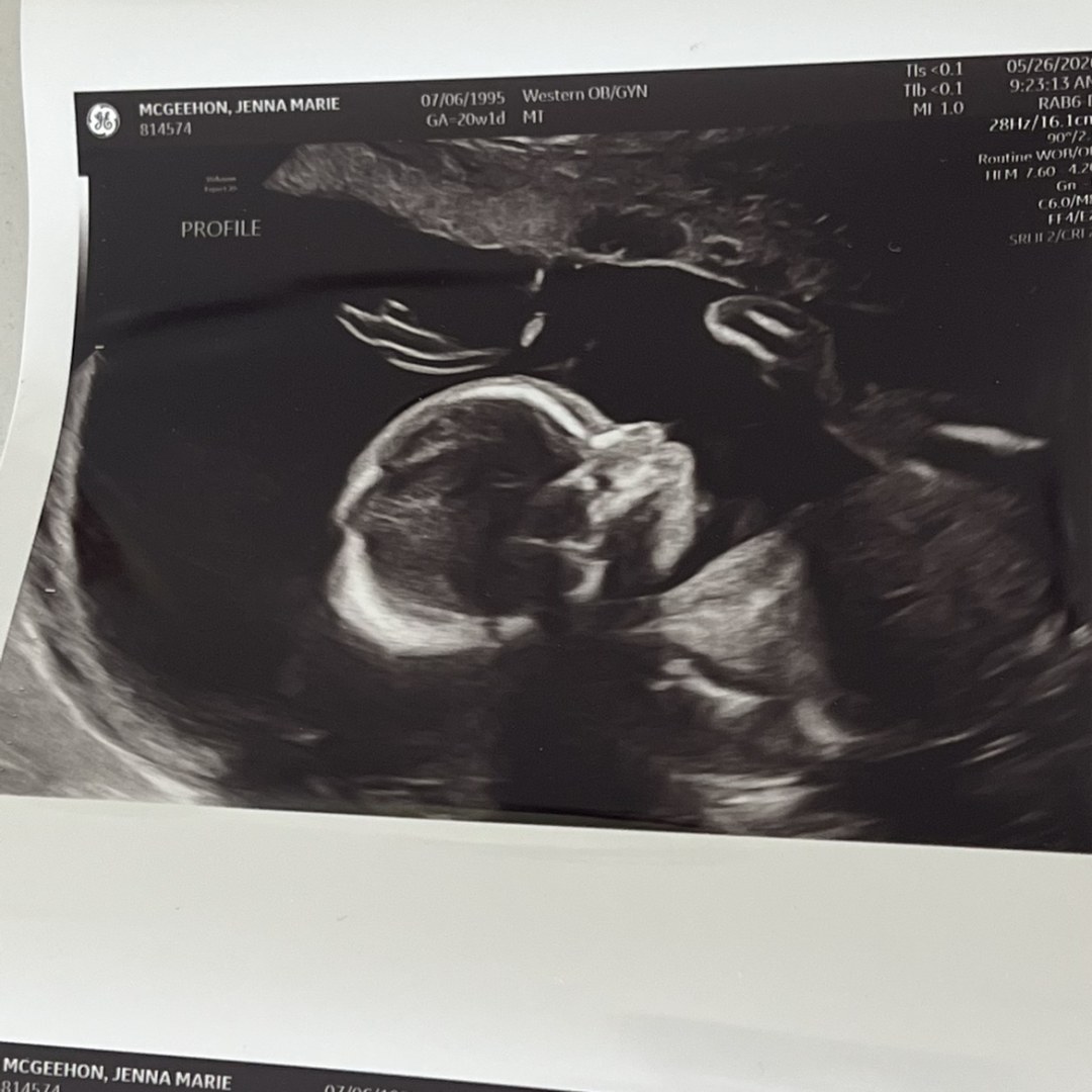Photo shared by Jenna for their Babylist baby registry.