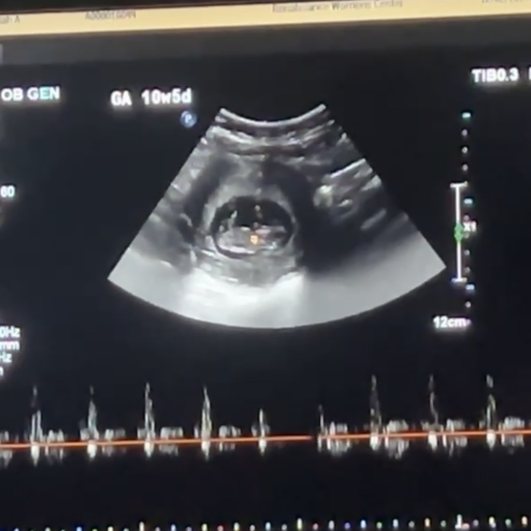 Photo shared by Kaliah for their Babylist baby registry.