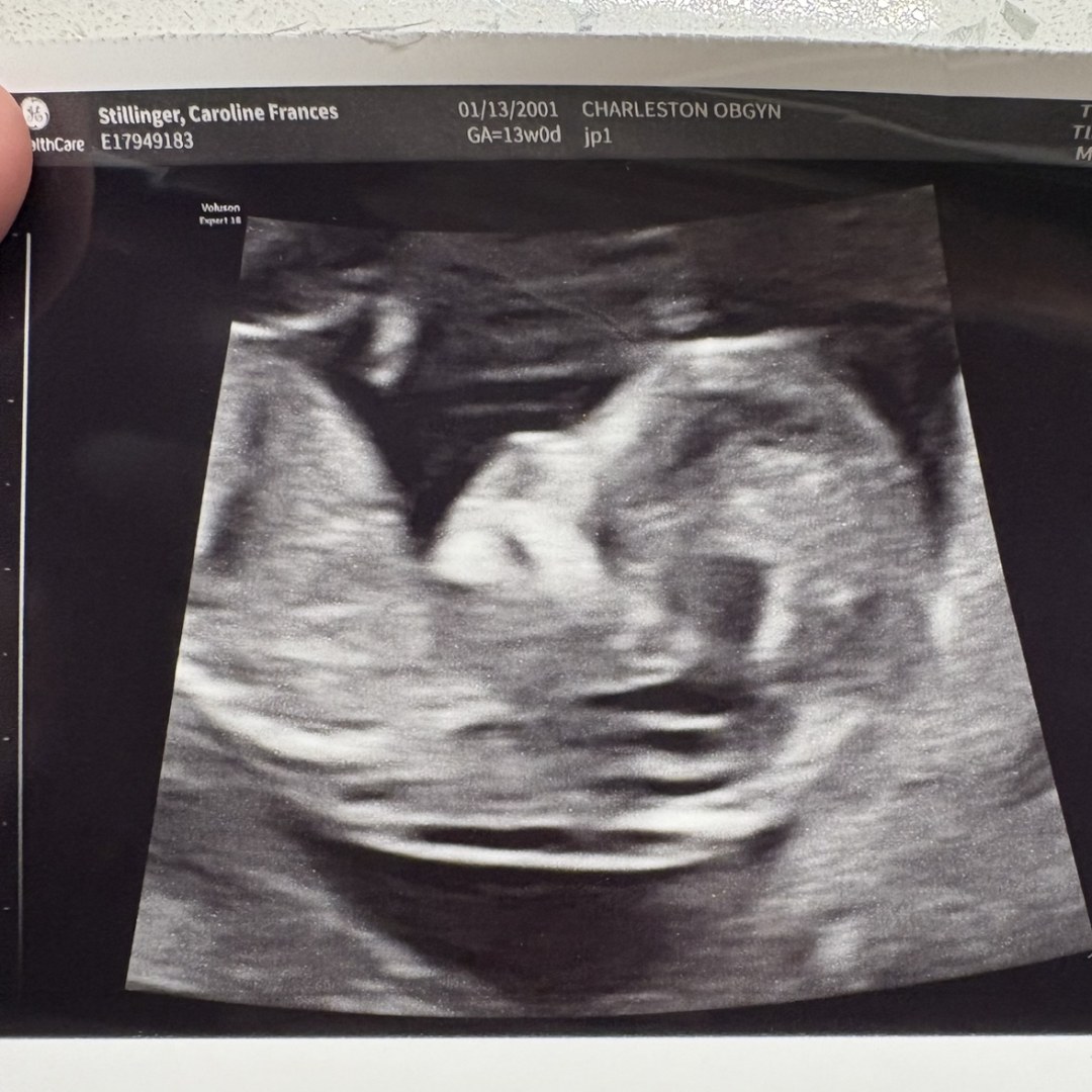 Photo shared by Caroline for their Babylist baby registry.