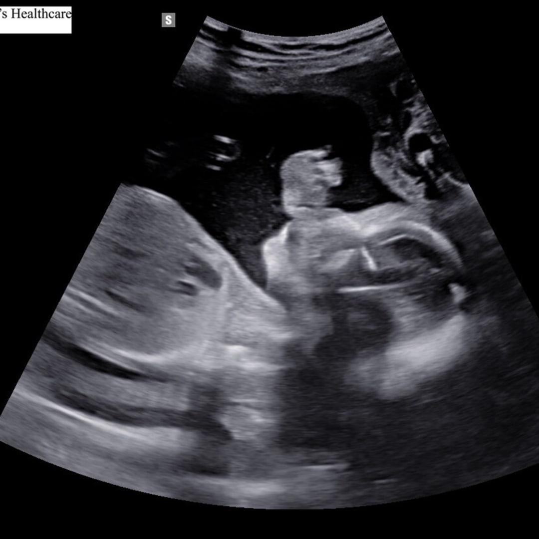 Photo shared by Madison for their Babylist baby registry.