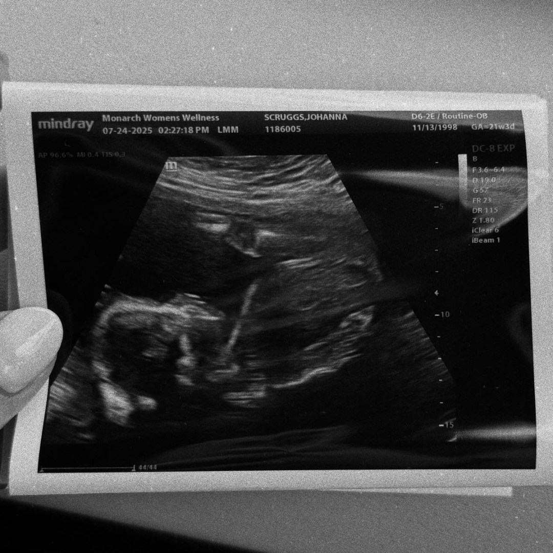 Photo shared by Grace for their Babylist baby registry.